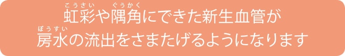 血管新生緑内障が起きるまで 血管新生緑内障が起きるまで