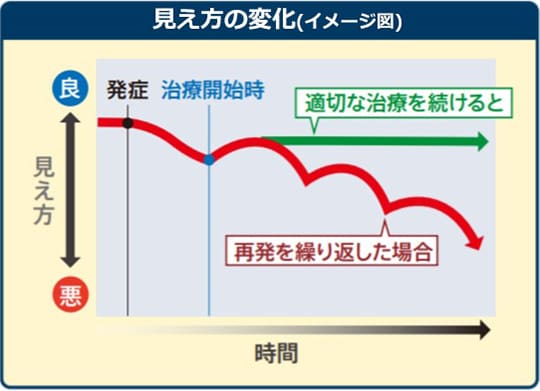 図①：これまでの治療法による視力の変化 画像