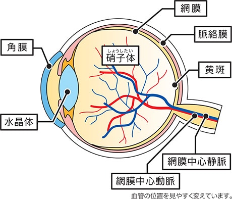 網膜静脈閉塞症