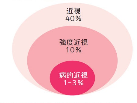 アジア人の近視の割合