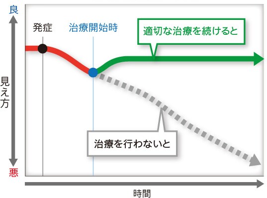 見え方の変化（イメージ図）