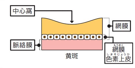 正常な状態と糖尿病網膜症、糖尿病黄斑浮腫の比較図